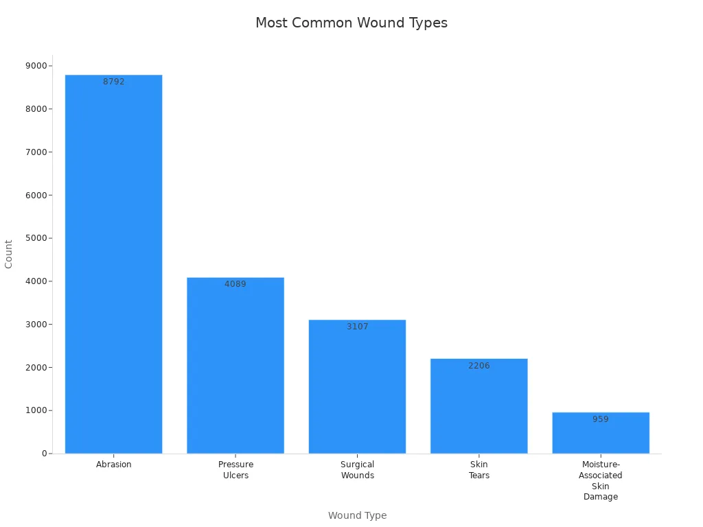 Bar chart showing counts of common wound types