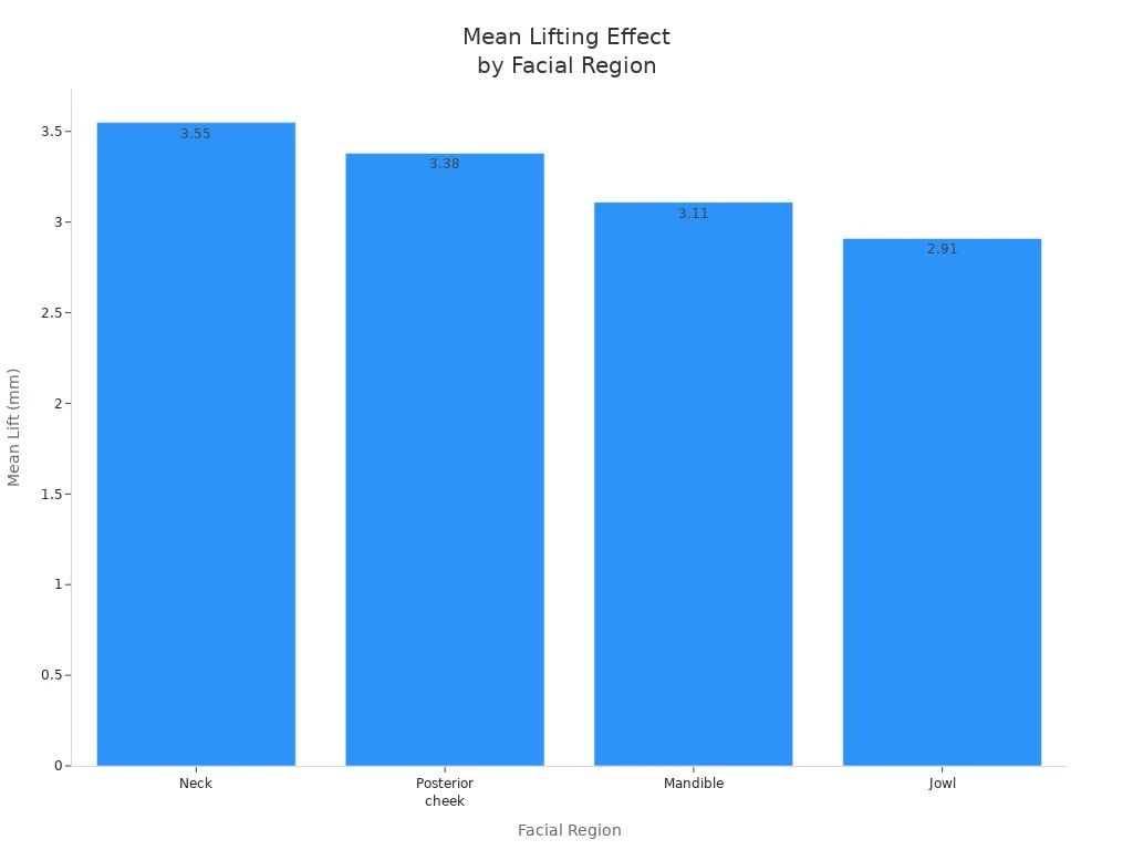 Bar chart showing mean lift in mm for neck, posterior cheek, mandible, and jowl after HIFU treatment