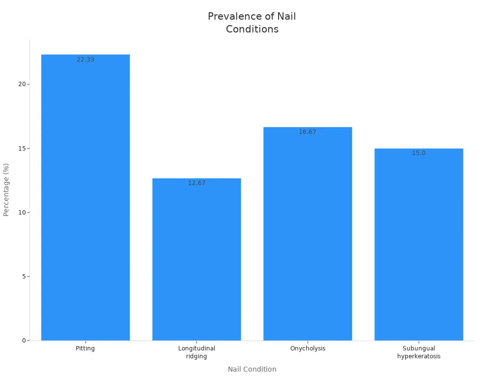 Bar chart comparing prevalence of pitting, longitudinal ridging, onycholysis, and subungual hyperkeratosis in nails