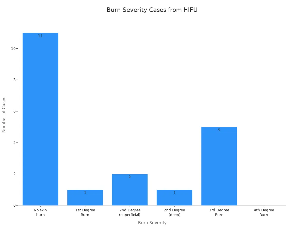 Bar chart showing number of cases for each burn severity after improper HIFU cartridge depth selection