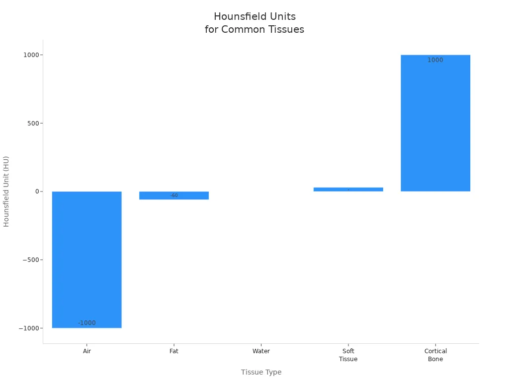 Gráfico de barras que muestra los valores de la unidad de Hounsfield para aire, grasa, agua, tejido blando y hueso cortical