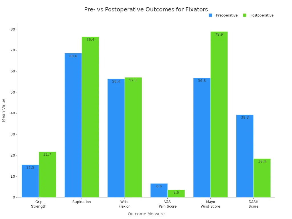 Grouped bar chart comparing preoperative and postoperative mean values for six wrist outcome measures