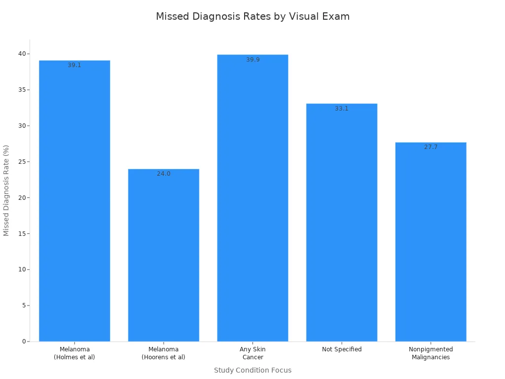 Bar chart showing missed diagnosis rates for various skin conditions from visual examinations alone.