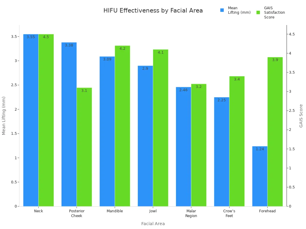 Bar chart comparing mean lifting and GAIS satisfaction scores for HIFU treatment across facial areas